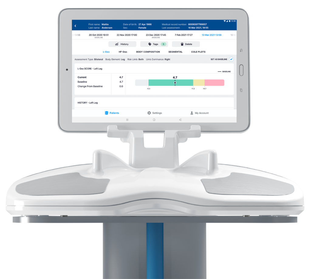 ImpediMed SOZO Device featuring L-Dex Analysis