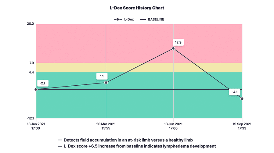 L-Dex Score History Chart