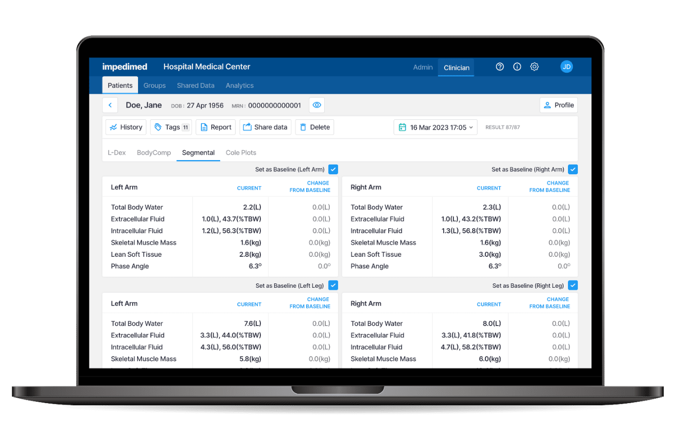 Impedimed Segmental BodyComp™ Analysis