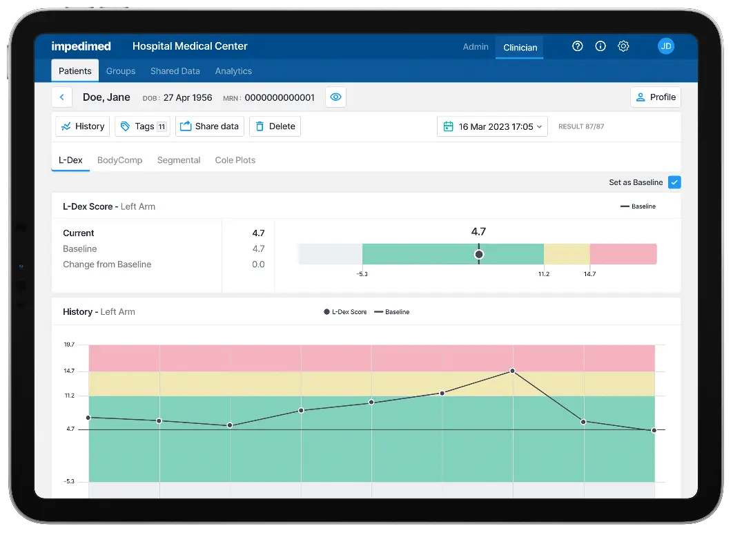 Tablet screen with L-Dex Analysis