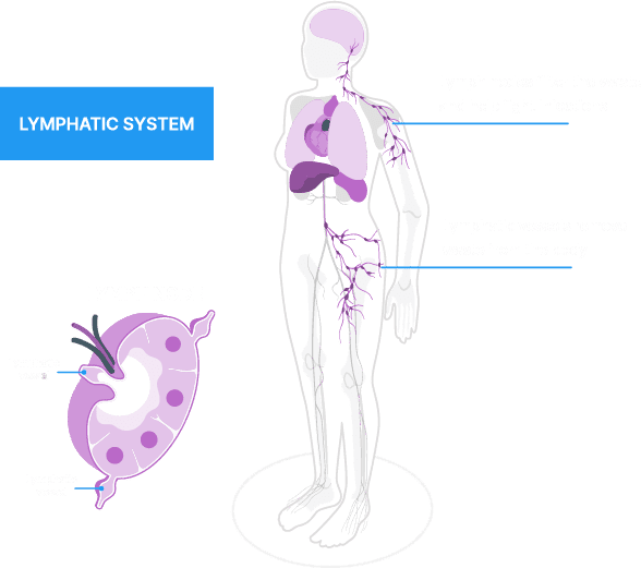 Illustration of the human lymphatic system with labeled lymph nodes, vessels, and a side inset.