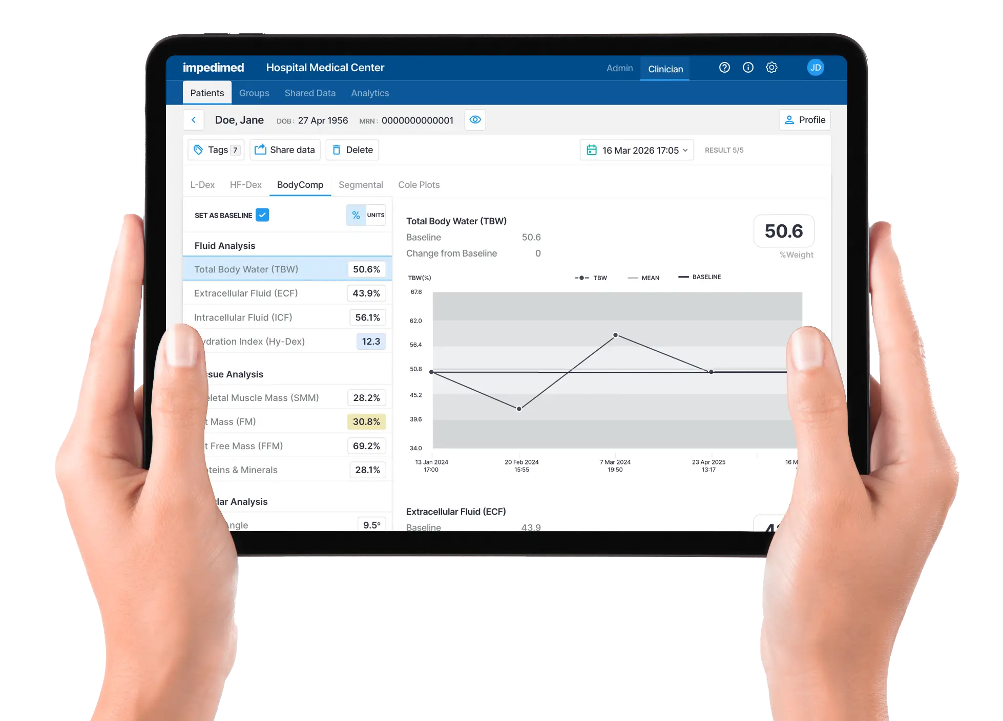 LBL-537-en SOZO App and System IFU (OUS) | ImpediMed Body Comp Analysis